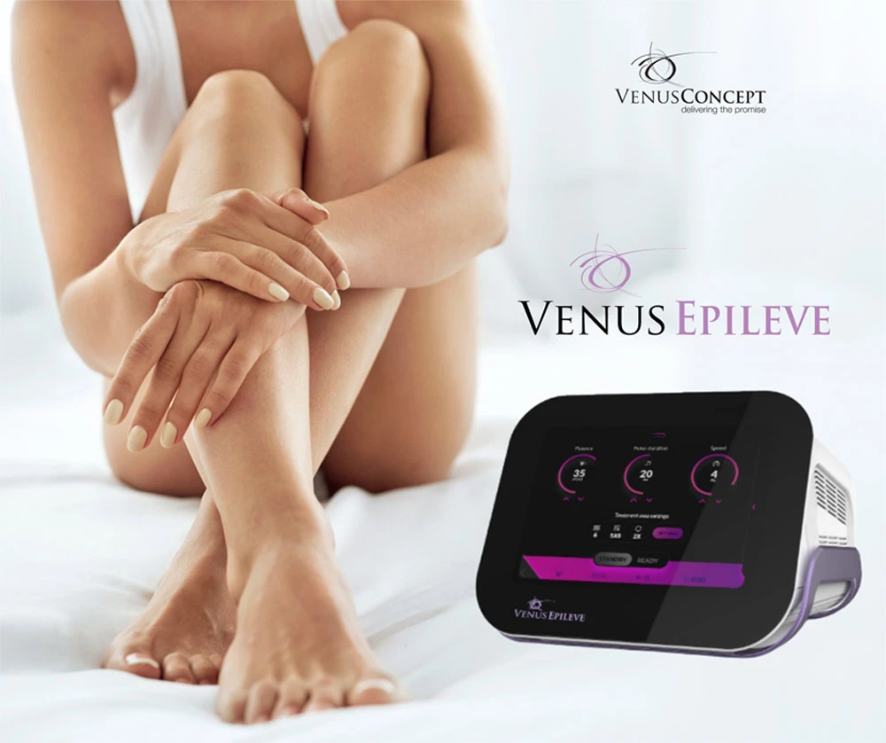 aparat-venus-epileve1